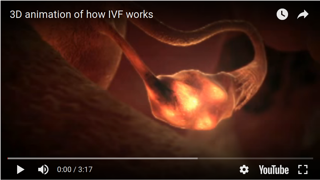 3D Animation of How IVF works